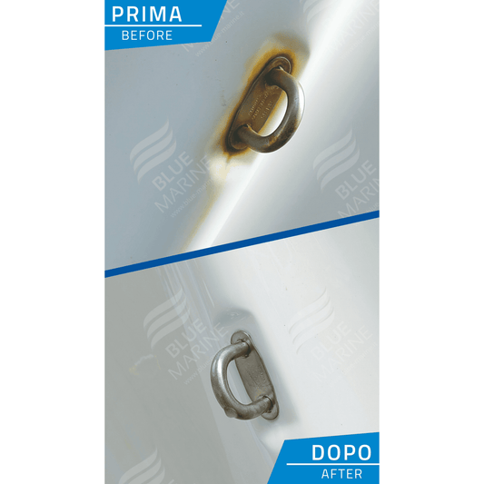 Laser Gel - acidic descaler